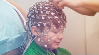 High Density HD EEG Testing Services [upl. by Pooley422]