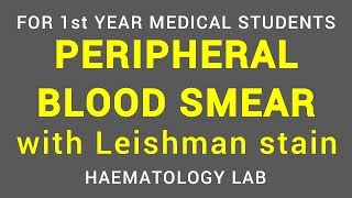 PERIPHERAL BLOOD SMEAR  LEISHMAN STAIN  HAEMATOLOGY LAB  PHYSIOLOGY [upl. by Aralc]