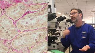 Microscope tutorial  Troubleshooting the Van Gieson stain [upl. by Ailel29]