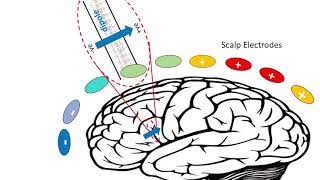 EEG  Electrical Brainwaves [upl. by Langham]