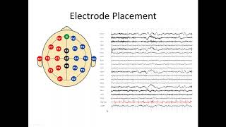 What is EEG [upl. by Busey723]