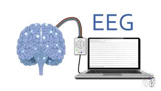 QEEG Brain Scans Explained [upl. by Scevo]